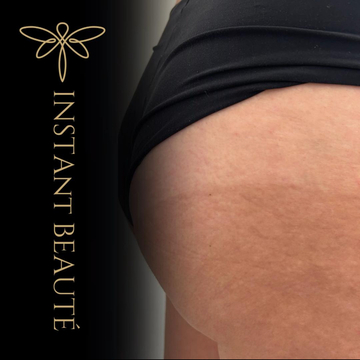 Soin bronzant spray tan à Angoulême